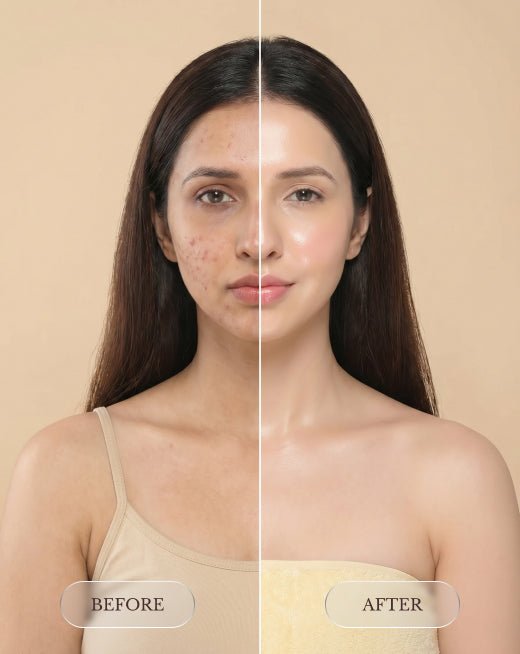 Brightening Body Lotion (Niacinamide+ Bifida Ferment Lysate + Ceramide NP) - Cham beauty